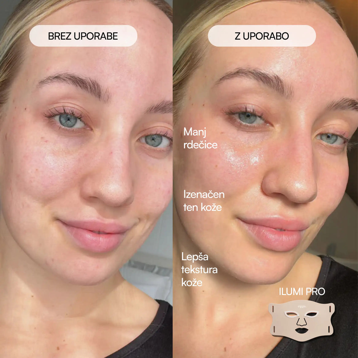 Ilumi Pro